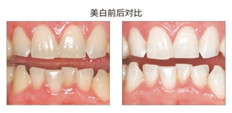 图片5