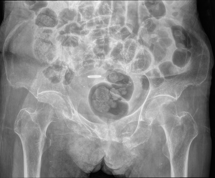 5520a31af0557b0b5e93f813b44b19e4 5520a31af0557b0b5e93f813b44b19e4