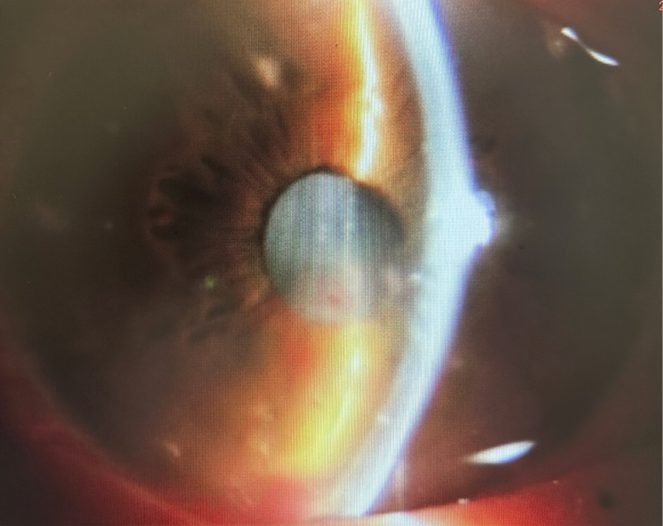 7bc09fd9d69146c1a8d4e163baf85ff0 7bc09fd9d69146c1a8d4e163baf85ff0